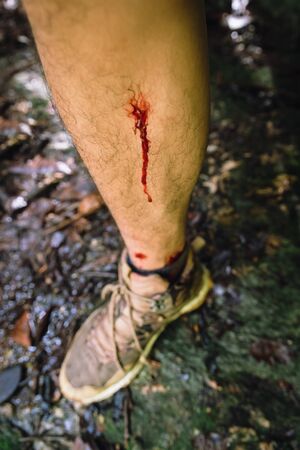 Wounds and blood on men foot caused by bloodsucker in Hala Bala wildlife sanctuary. Thailand.の写真素材