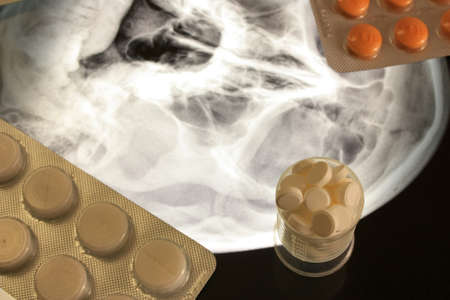 Pills for treatment and x-ray of the human head