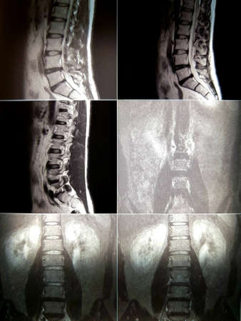 X-ray of the human spine
