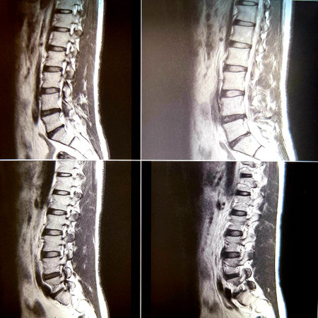X-ray of the human spine, part of the human body.