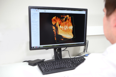 Doctor dentist viewing panoramic picture of the jaw on the computer. The concept of health and modern medicine.の写真素材