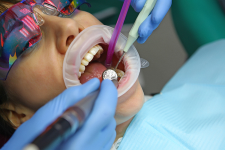 Macro photo of a patient on dental treatment in the dental office. The concept of health and beauty. Photov doctor's officeの写真素材