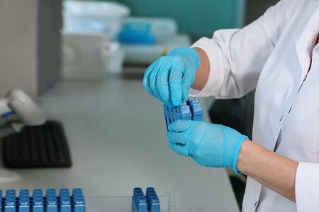 Laboratory assistant hand in gloves with test tubes and cartridges. medical research concept....