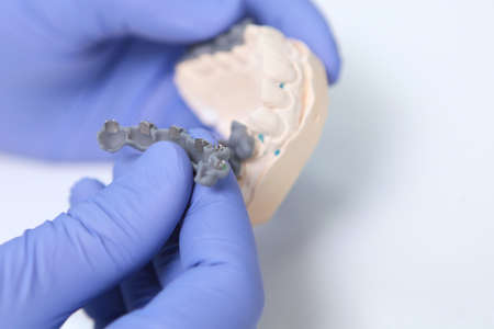 Braces or staples before installation. Jaw model. Unrecognizable until ktor. Hands in protective...