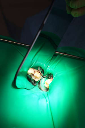 Soft white cheese of different shapes on a board with a mint branch and honey. Vertical photo on a black background. Top view.の写真素材