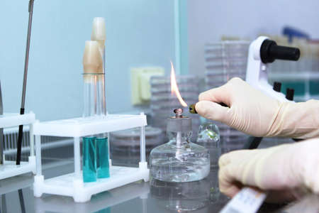 A laboratory technician lights an alcohol burner in a research laboratory. Development of a new...