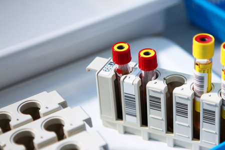 Test tubes with biomaterials in the laboratory. The concept of medical research.Clinical and diagnostic laboratory. Top view.の写真素材