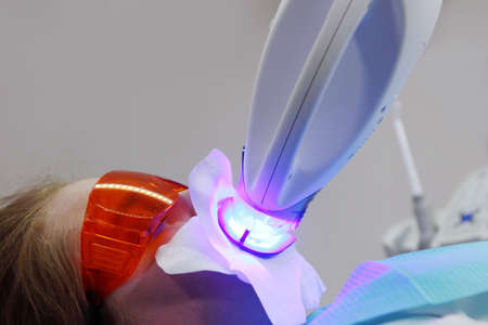 Teeth whitening in dental clinic. Young woman whitens her teeth with special equipment. Dental...