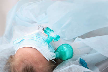 Child's face is covered with a mask. A breathing tube in the mouth. The child is under anesthesia. Preparing for surgery. Copy space.の写真素材