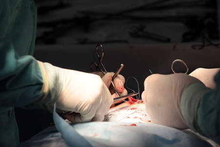 Completion of the operation to remove the inguinal hernia. The surgeon sutures after laparoscopic...