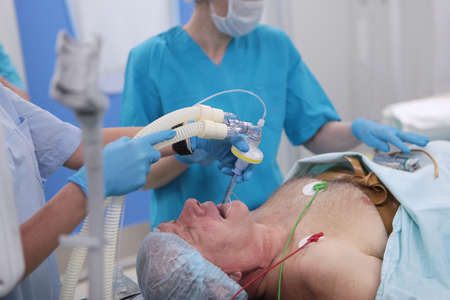 Installation of breathing tube during anesthesia.Medical equipment for introduction of anesthesia. A breathing mask on patient's face.Medical anesthesia. Preparation for operation. Saving life. Donation concept.の写真素材