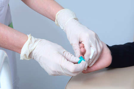 Taking tests in a medical laboratory. Close-up of the nurse's hands. Preparation of medical...