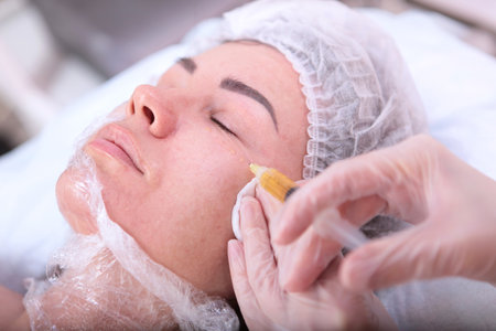 Cosmetologist makes injections of plasmolifting for the face. Plasmolifting procedure. Blood in a test tube. The hands of a cosmetologist. Close-up.The concept of cosmetology.の写真素材