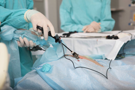 Doctor performs the operation using a camera and a laparoscopic instrument. Laparoscopic surgery. Penetration into the abdominal cavity. Surgical team.の写真素材