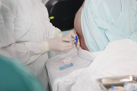 Blockade of the spinal nerve. Epidural anesthesia. Injections of epidural anesthesia. Preparation for the operation.の写真素材