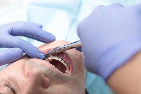 A device for correcting human teeth. Braces on the teeth. Orthodontic treatment. Malocclusion. A man with metal braces on his teeth. A man with braces on his teeth.の写真素材