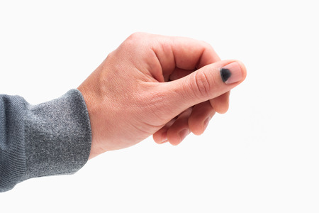 Black nail. Hammer on the thumb. Pain and hematoma after injury. Male hand isolated on white backgroundの写真素材