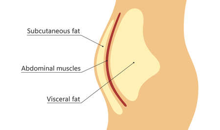 Visceral and subcutaneous fat around waistline. Location of visceral fat in abdominal cavity. Types of human obesity. Medical scheme. Vector illustration isolated on white background.のイラスト素材