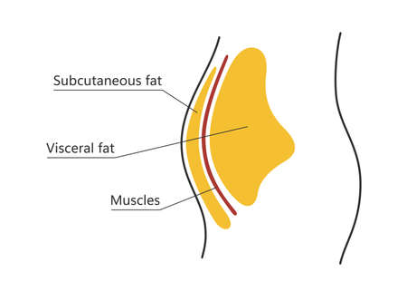 Visceral and subcutaneous fat around waistline. Location of visceral fat in abdominal cavity. Types of human obesity. Medical scheme. Vector illustration isolated on white background.のイラスト素材