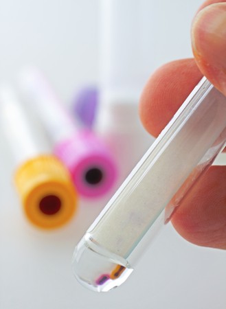 Male hand holding a test tube, with others on the backgroundの写真素材