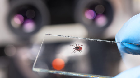 Parasitic castor bean tick on glass slide in hand of laboratory technician.  Diagnosis tick-borne...
