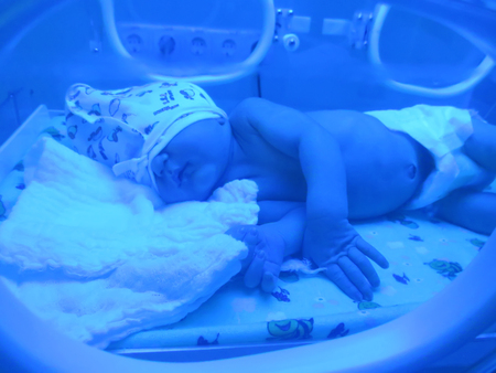 Odessa, Ukraine - October 9, 2014: Obstetrics and Gynecology Hospital. Newborn babies born to mothers who suffered from jaundice. Doctors provide children in the incubators under the blue light UV light to treat children and recover from the disease with のeditorial素材