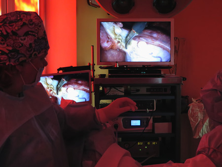 Odessa, Ukraine - October 9th, 2014 : The surgeon and the staff conducting laparoscopic surgery with an electronic monitor, this is a medical imaging technique used to visualize internal organs of control over the course of the operation.のeditorial素材