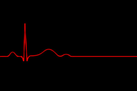 Red cardiogram on a black background, vector art illustration.のイラスト素材