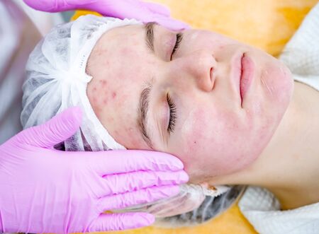 Female derma rejuvenate treatment. Doctor in gloves touch woman face. Cosmetology pretty portrait. Application of anti-acne creamの写真素材
