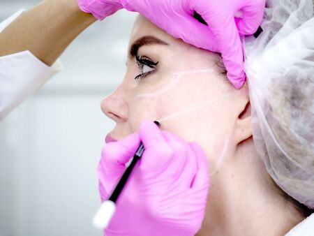 Beautician draws the contours of a white pencil on the face of the patient. Schematic marking before contouring. Close-up preparation of the face for cosmetic plastic surgery. Profileの写真素材