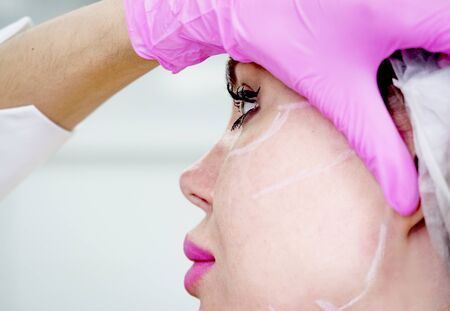 Beautician draws the contours of a white pencil on the face of the patient. Schematic marking before contouring. Close-up preparation of the face for cosmetic plastic surgery. Profileの写真素材