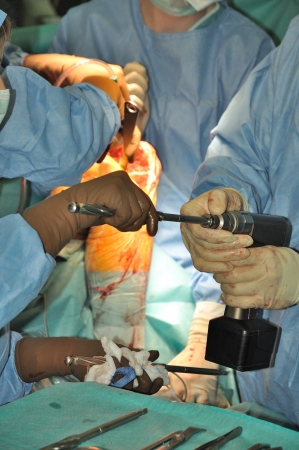 Prosthesis of the knee hospital operation の写真素材