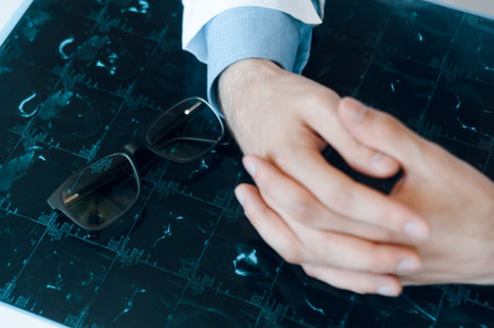 folded hands of the doctor lie on the table on the mri shot diagnosisの写真素材