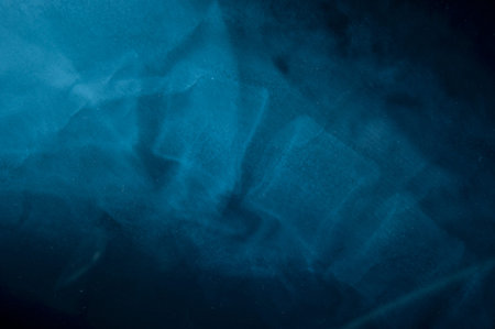 X-Ray film of the patients in the hospital