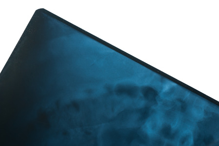 X-Ray film of the patients in the hospitalの写真素材