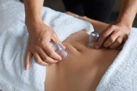 Young beautiful woman enjoying cupping massage in spa.Professional massage therapist is treating a...