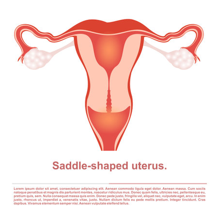 Illustration, female reproductive organ, the saddle form the uterus.のイラスト素材