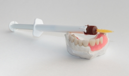 Artificial dentalny designs and modern fixing material for them の写真素材