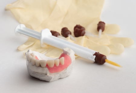 Artificial dentalny designs and modern fixing material for them の写真素材