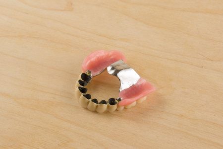 new dentures with metal-ceramic crowns lie on a wooden table