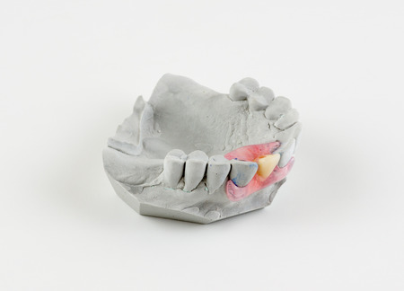 dentures made of nylon type of butterfly is made of one missing toothの写真素材