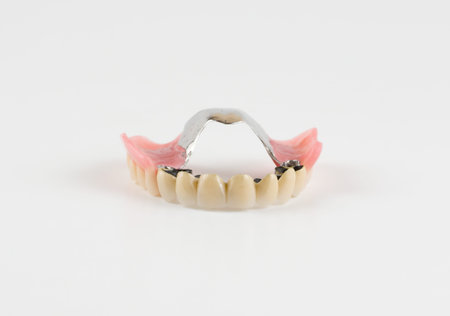 Clasp prosthesis with and attachments fixing ceramic crowns