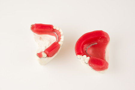dental prosthesis manufacturing step in dental laboratoriesの写真素材