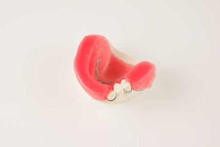 dental prosthesis manufacturing step in dental laboratories