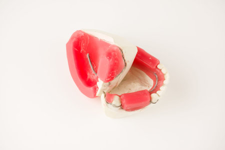 dental prosthesis manufacturing step in dental laboratories