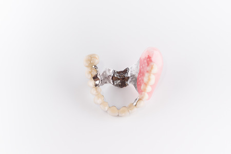 Clasp prosthesis with and attachments fixing ceramic crownsの写真素材