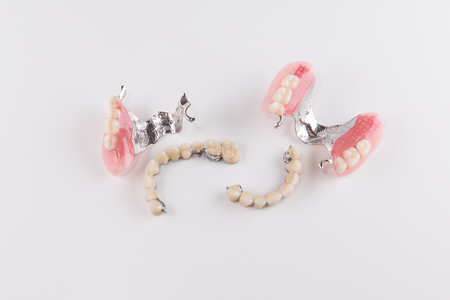 Clasp prosthesis with and attachments fixing ceramic crownsの写真素材