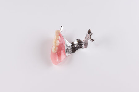 Clasp prosthesis with and attachments fixing ceramic crowns