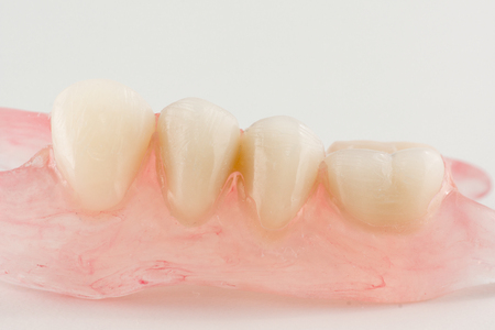 modern nylon removable dental prosthesis for restoring dentitionの写真素材