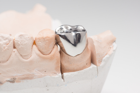 Steel artificial dental crown for dentition restorationの写真素材